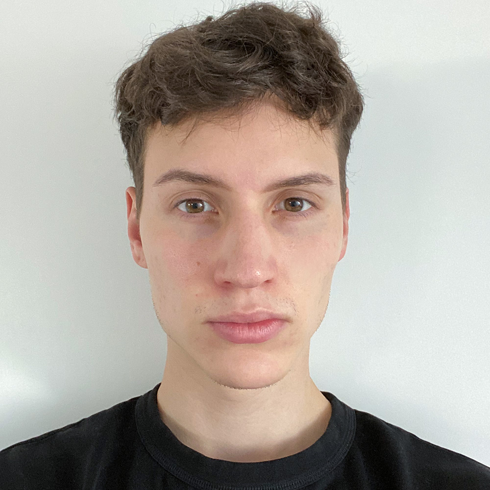 Cyrill Resultate Skin Clear Adult fettiger ölige Haut Pickel after