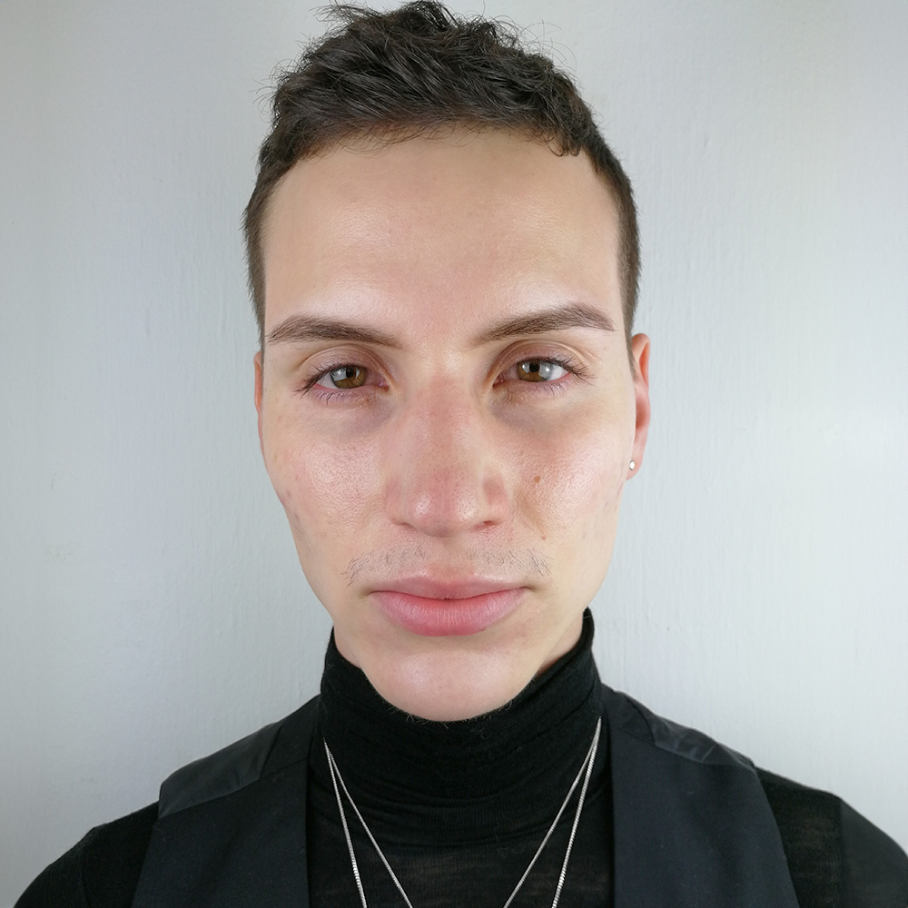 Cyrill Resultate Skin Clear Adult fettiger ölige Haut Pickel before