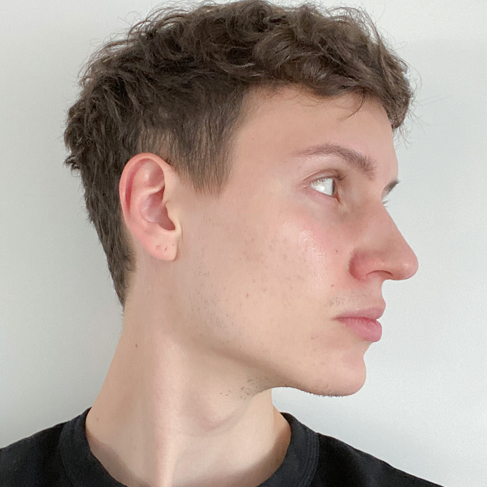 Cyrill Resultate Skin Clear Adult fettiger ölige Haut Pickel After